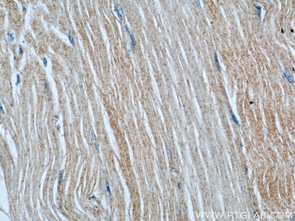 Immunohistochemistry (IHC) staining of human skeletal muscle tissue using RAB27A Monoclonal antibody (66058-1-Ig)