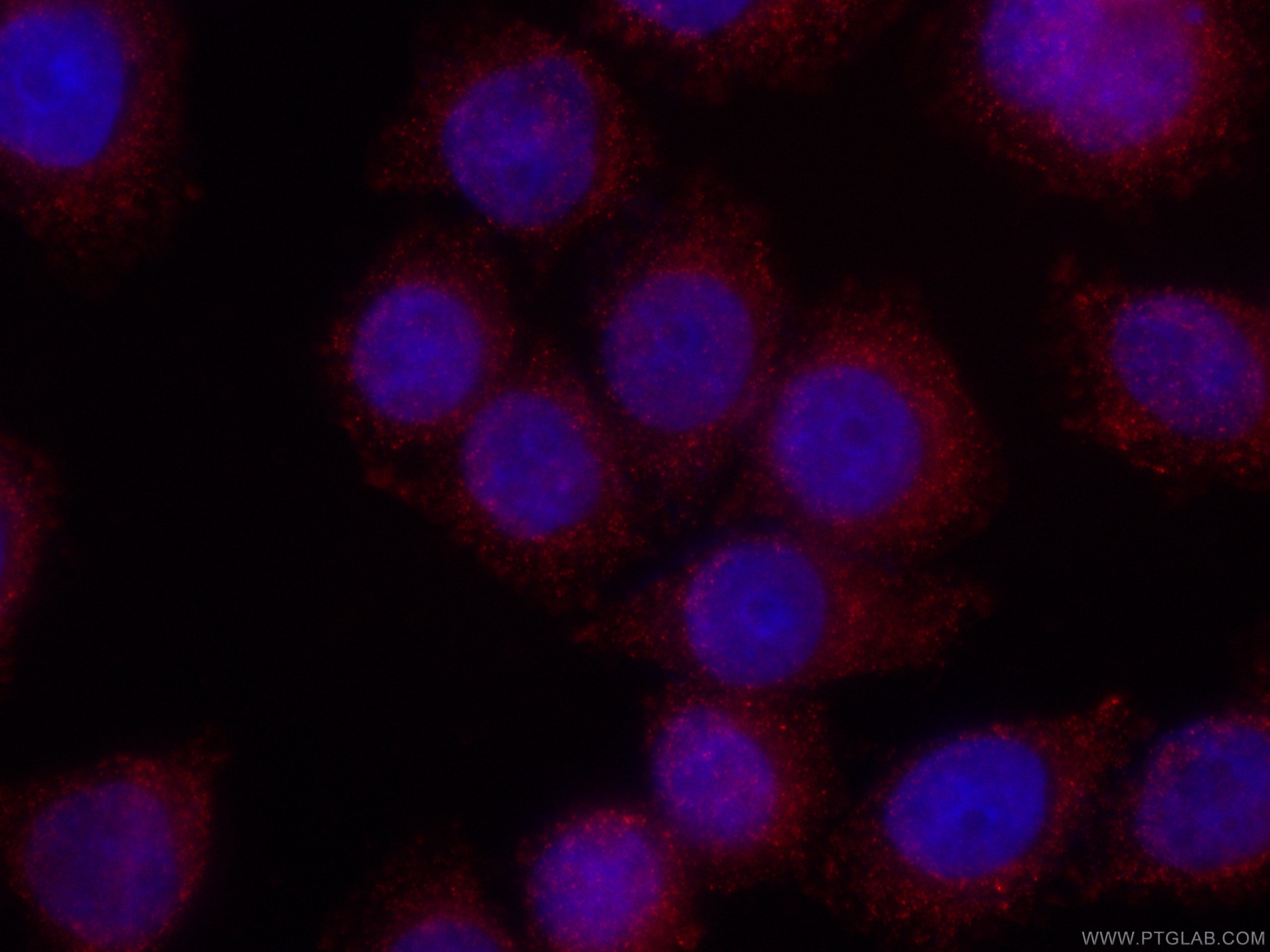 Immunofluorescence (IF) / fluorescent staining of HeLa cells using CoraLite®594-conjugated RAB27A Monoclonal antibody (CL594-66058)