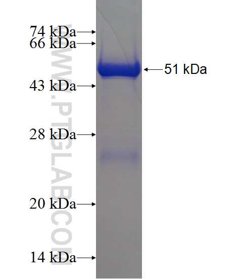 RAB27A fusion protein Ag12136 SDS-PAGE