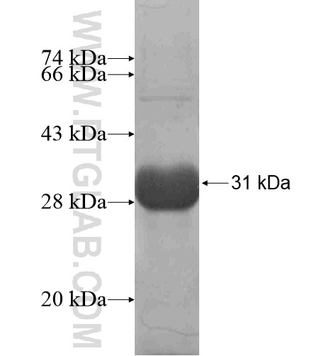RAB27A fusion protein Ag12382 SDS-PAGE