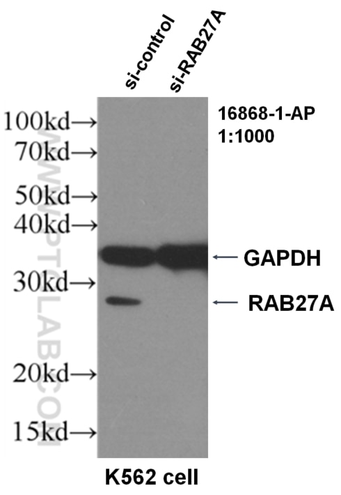 Western Blot (WB) analysis of K562 using RAB27A-specific Polyclonal antibody (16868-1-AP)