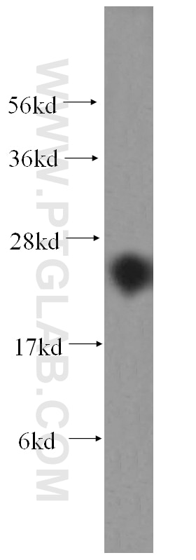 RAB27A-specific