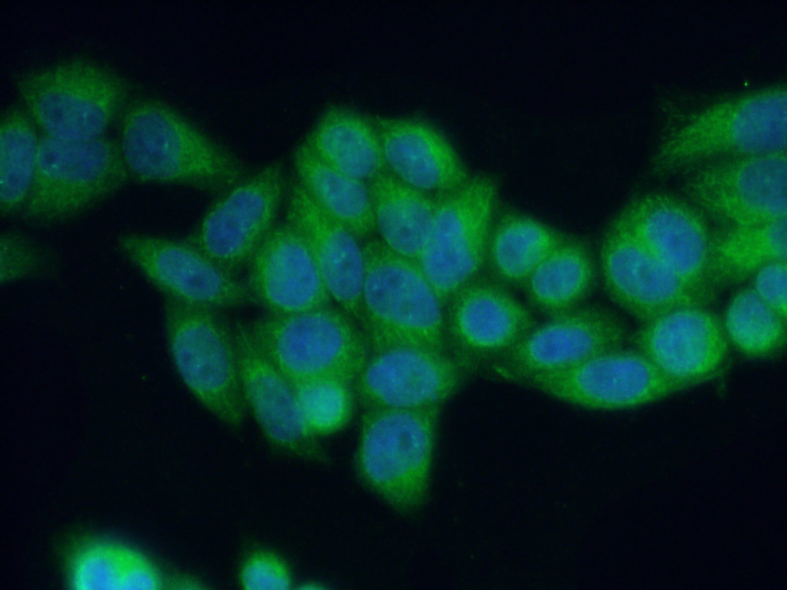 Immunofluorescence (IF) / fluorescent staining of HeLa cells using RAB27B Polyclonal antibody (13412-1-AP)