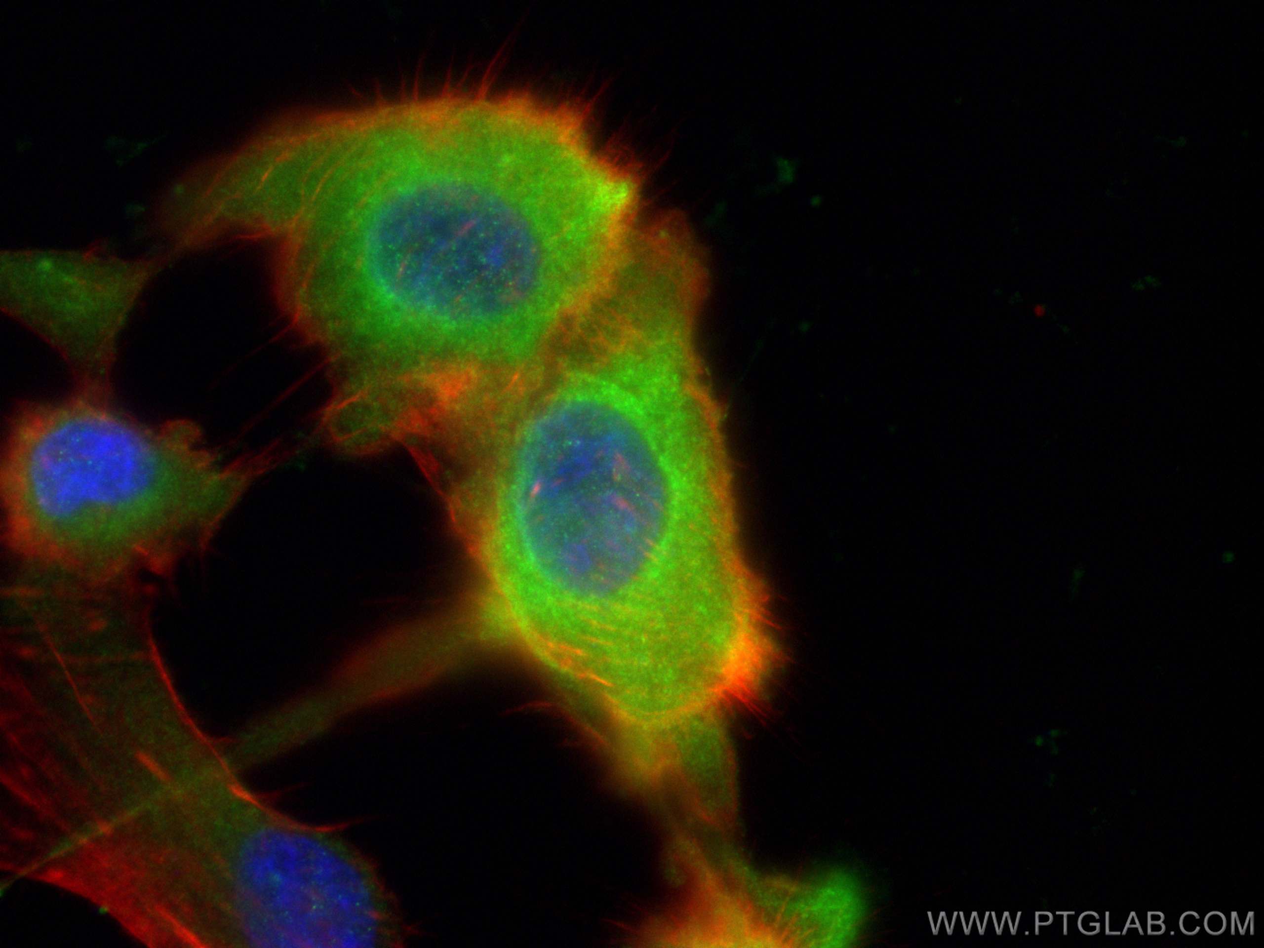 Immunofluorescence (IF) / fluorescent staining of U-87 MG cells using RAB27B Polyclonal antibody (13412-1-AP)