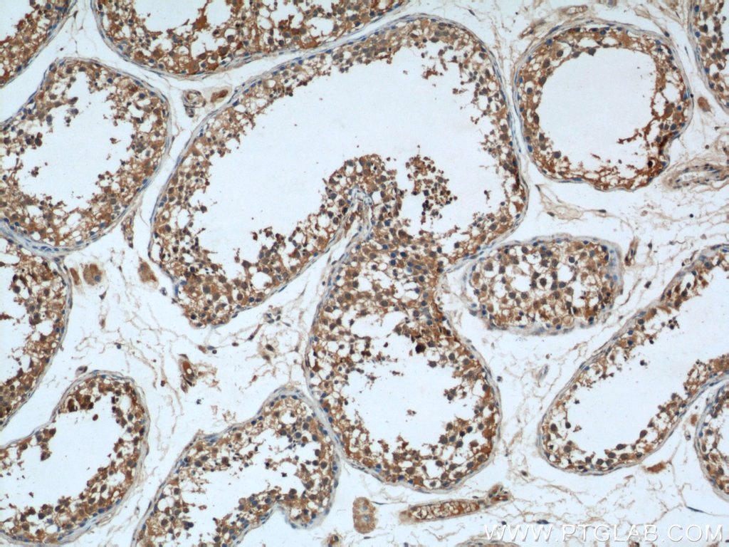 IHC staining of human testis using 13412-1-AP