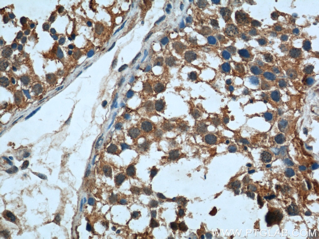 Immunohistochemistry (IHC) staining of human testis tissue using RAB27B Polyclonal antibody (13412-1-AP)