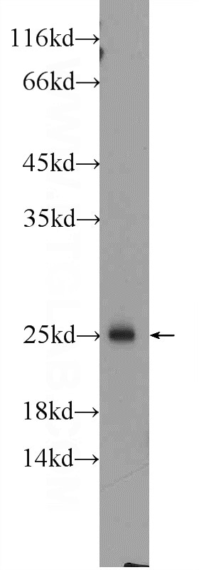 Western Blot (WB) analysis of rat spleen tissue using RAB27B Polyclonal antibody (13412-1-AP)