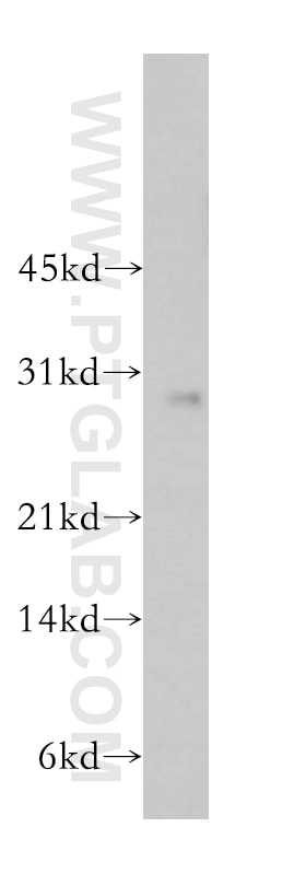 Western Blot (WB) analysis of A375 cells using RAB27B Polyclonal antibody (13412-1-AP)