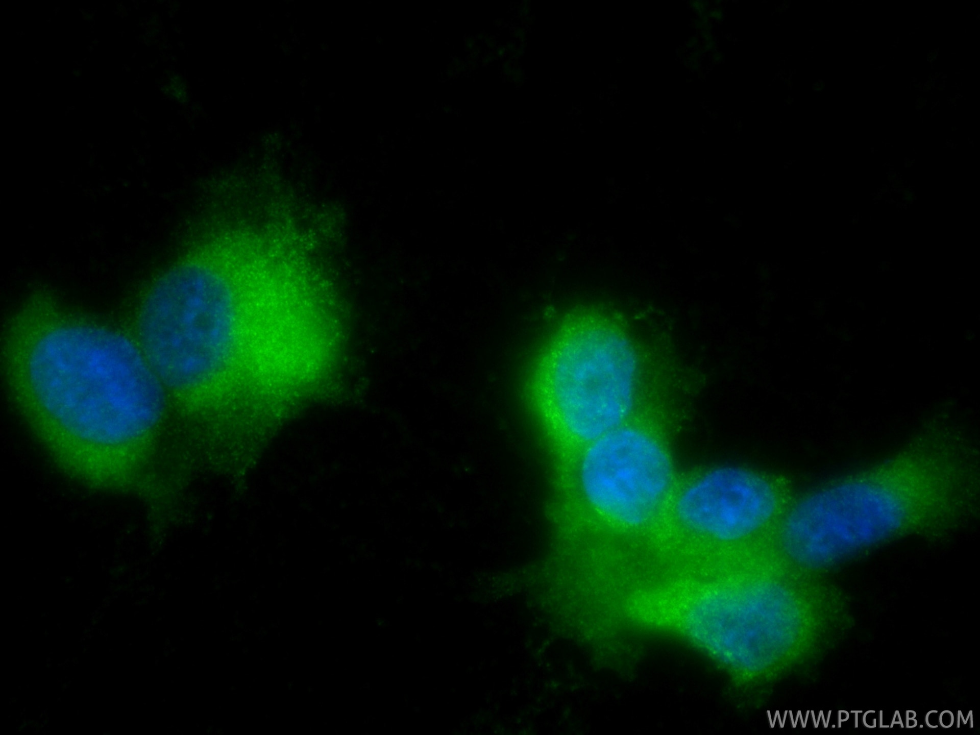 Immunofluorescence (IF) / fluorescent staining of U-87 MG cells using RAB27B Monoclonal antibody (66944-1-Ig)