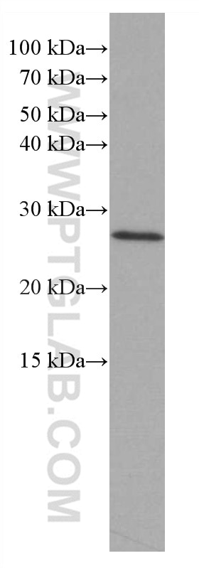 WB analysis of HeLa using 66944-1-Ig