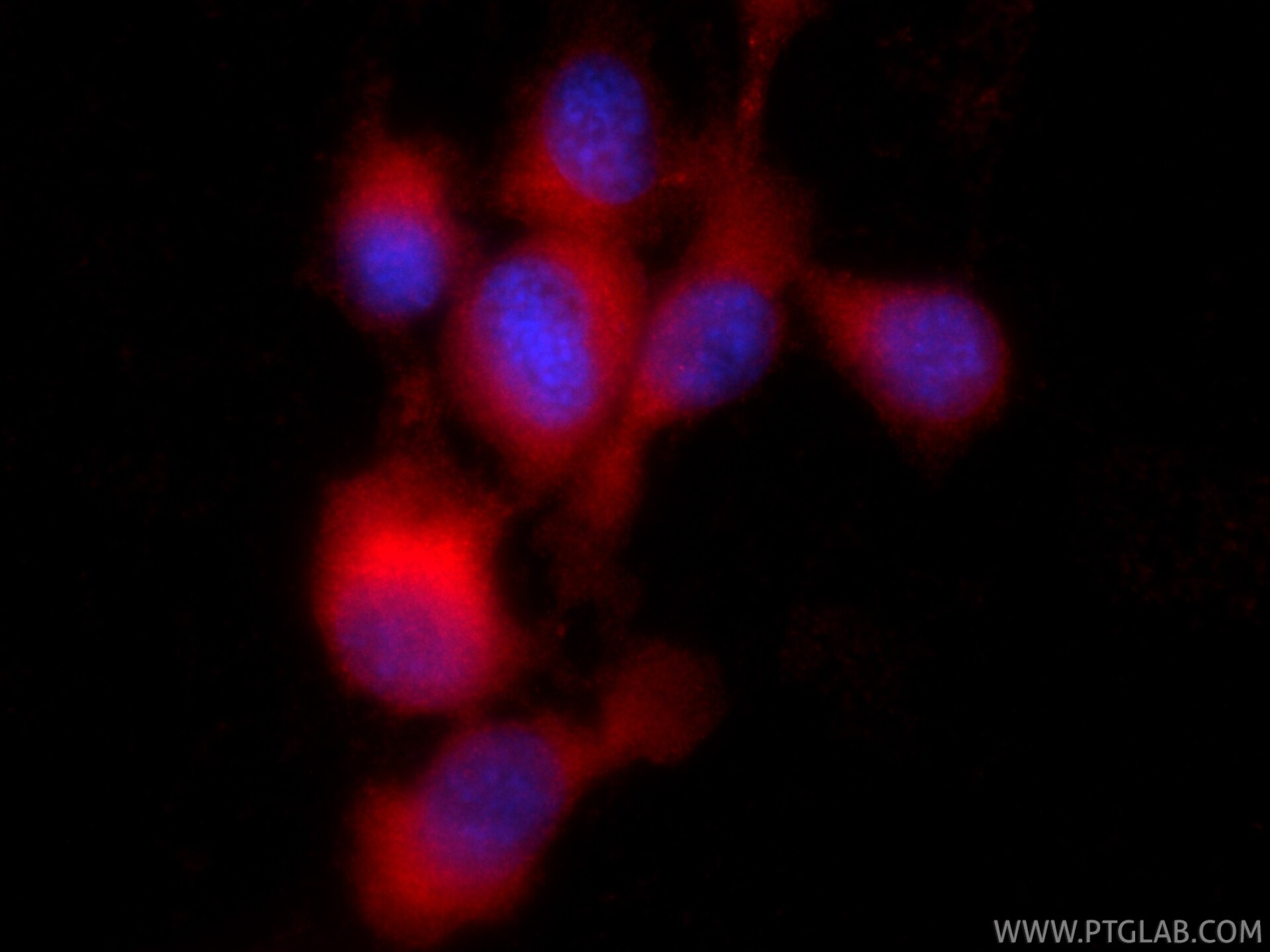 IF Staining of U-87 MG using CL594-66944 Immunofluorescence (IF) / fluorescent staining of U-87 MG cells using CoraLite®594-conjugated RAB27B Monoclonal antibody (CL594-66944)
