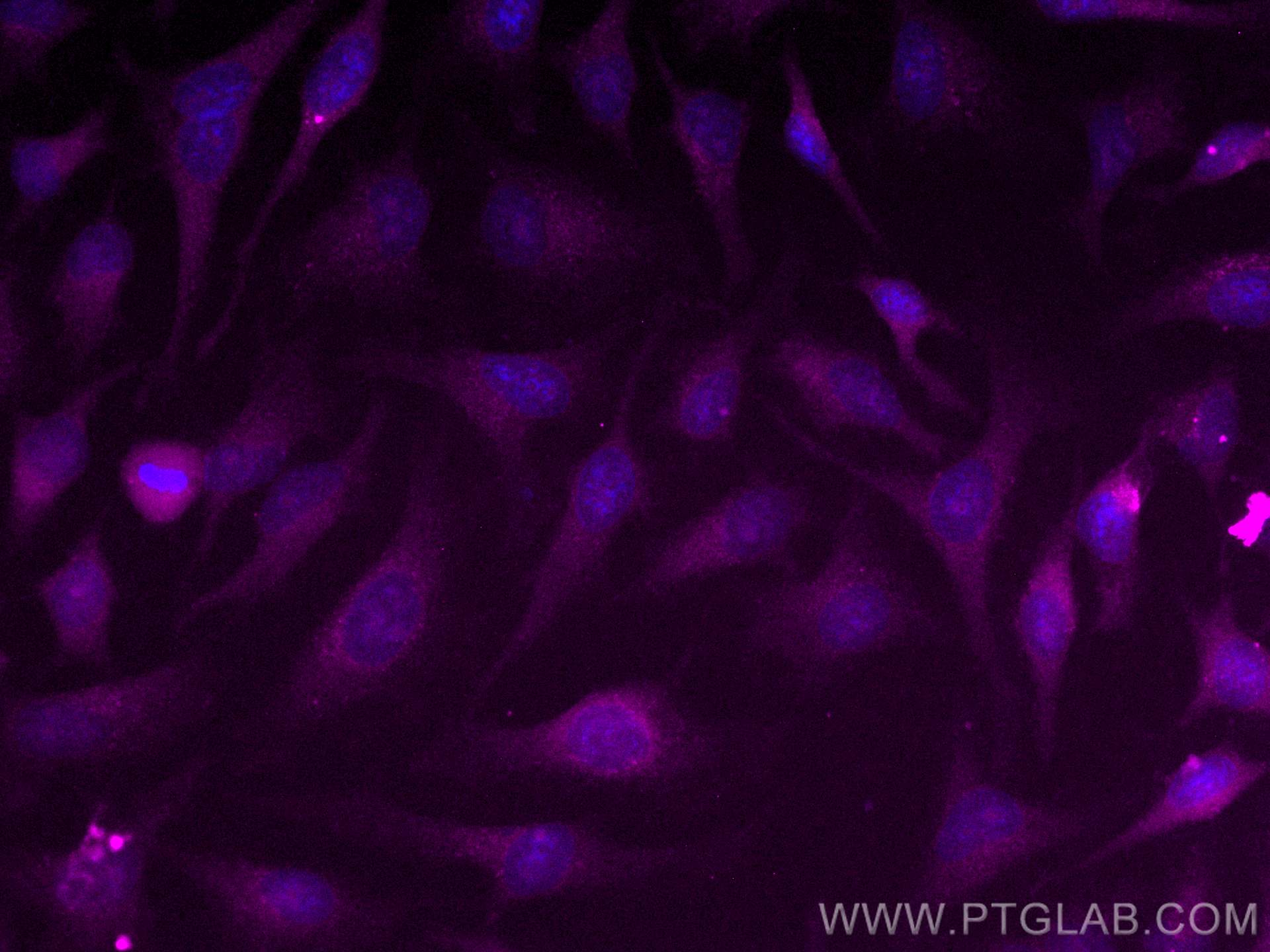 Immunofluorescence (IF) / fluorescent staining of HeLa cells using CoraLite® Plus 647-conjugated RAB27B Polyclonal an (CL647-13412)