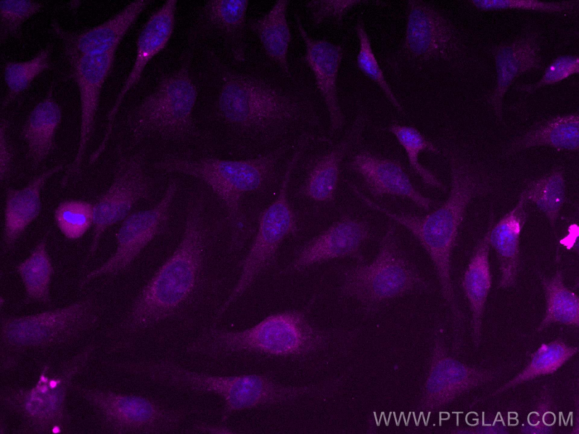 IF Staining of HeLa using CL647-13412