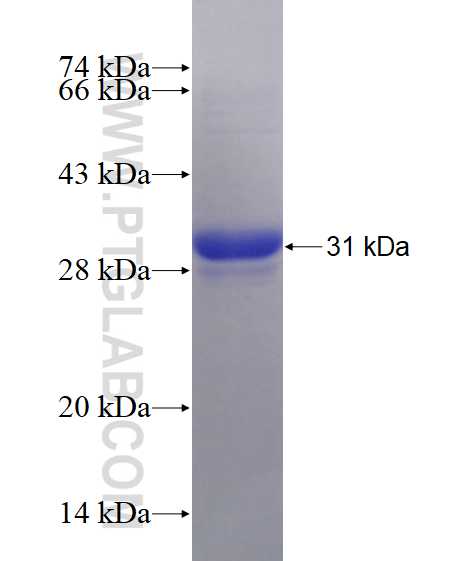 RAB27B fusion protein Ag18756 SDS-PAGE