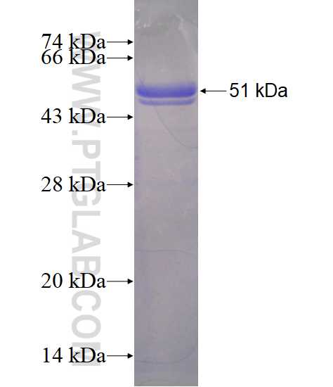 RAB27B fusion protein Ag4064 SDS-PAGE