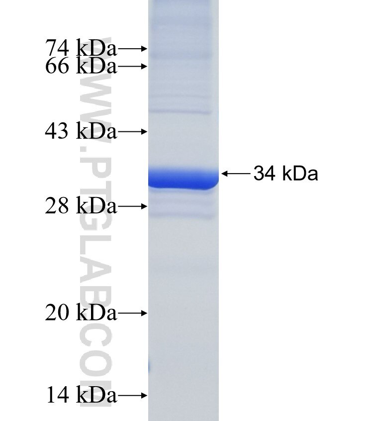 RAB28 fusion protein Ag4796 SDS-PAGE