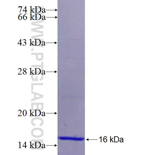 RAB28 fusion protein Ag5044 SDS-PAGE