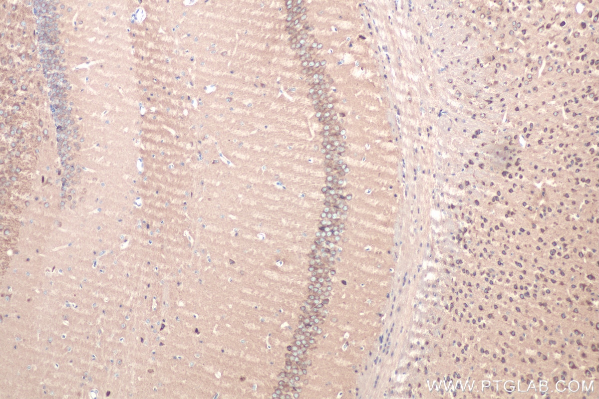 Immunohistochemistry (IHC) staining of mouse brain tissue using RAB2A/B Polyclonal antibody (15420-1-AP)