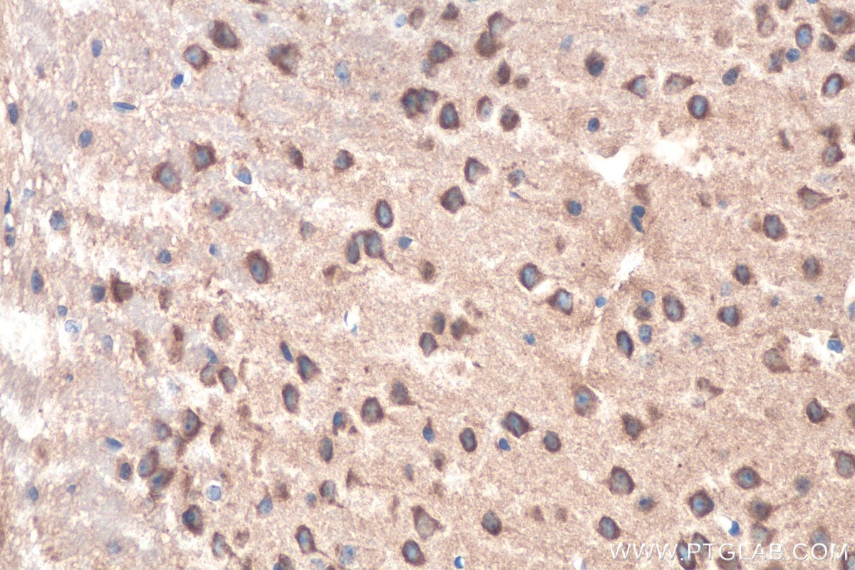 Immunohistochemistry (IHC) staining of mouse brain tissue using RAB2A/B Polyclonal antibody (15420-1-AP)