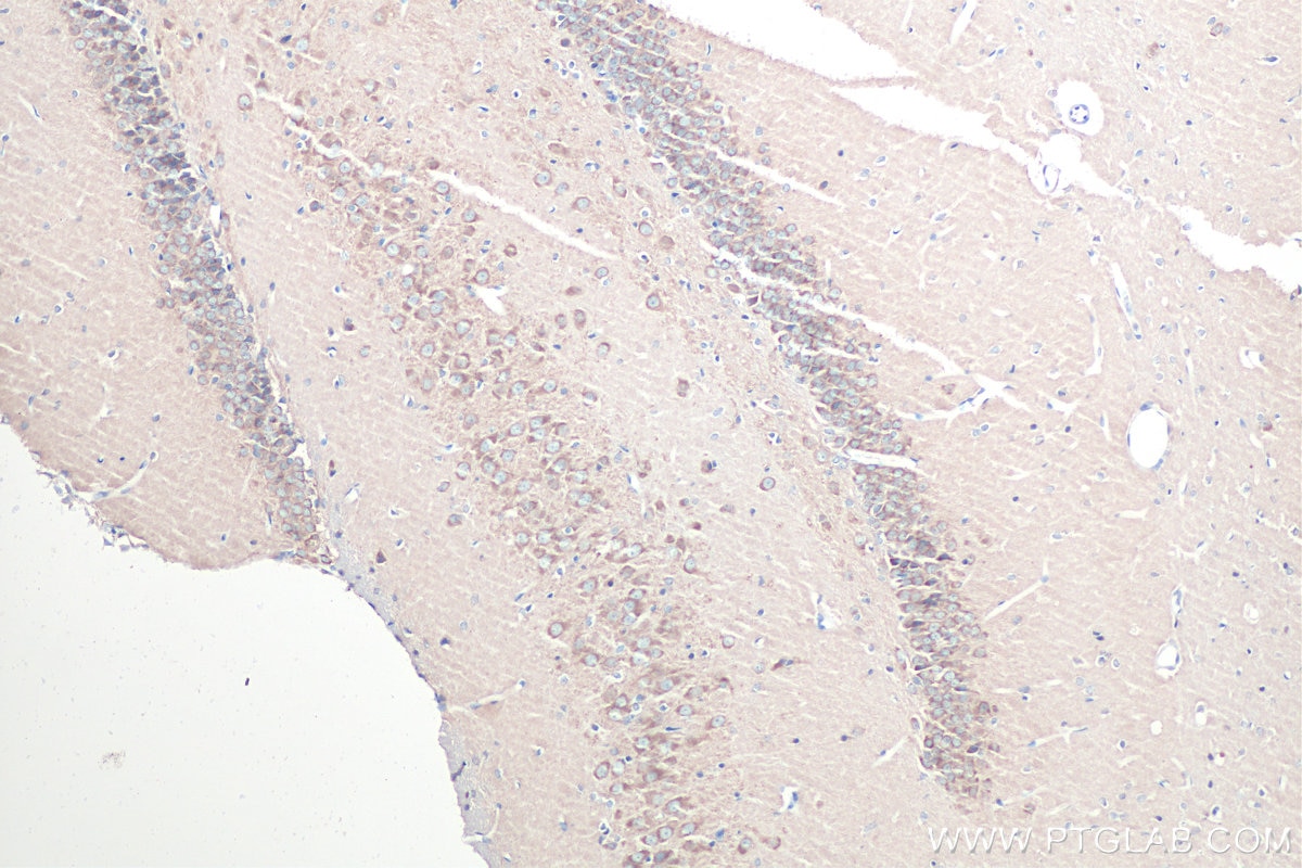 Immunohistochemistry (IHC) staining of rat brain tissue using RAB2A/B Polyclonal antibody (15420-1-AP)