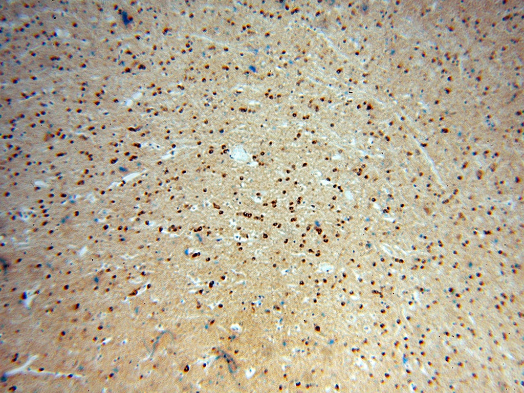 IHC staining of human brain using 15420-1-AP