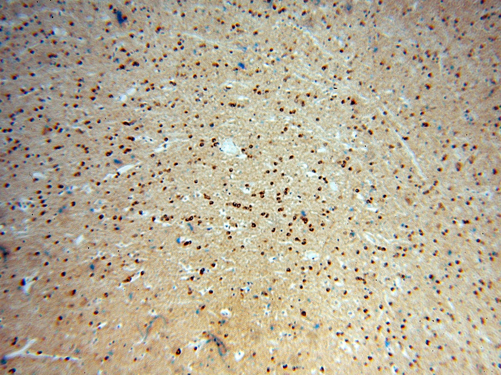 Immunohistochemistry (IHC) staining of human brain tissue using RAB2 Polyclonal antibody (15420-1-AP)