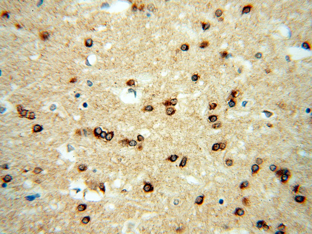 Immunohistochemistry (IHC) staining of human brain tissue using RAB2 Polyclonal antibody (15420-1-AP)