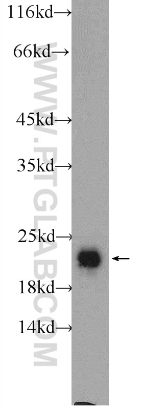 Western Blot (WB) analysis of rat brain tissue using RAB2 Polyclonal antibody (15420-1-AP)