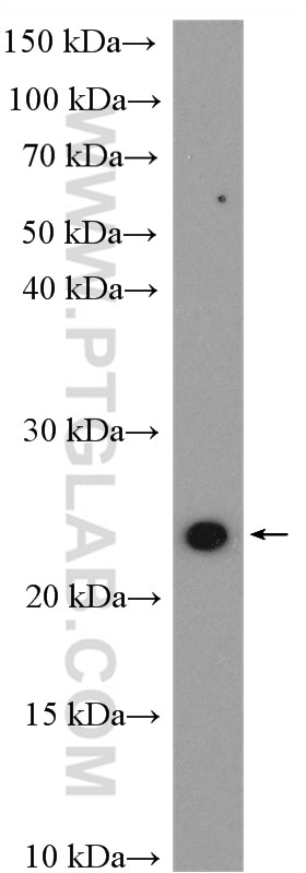 Western Blot (WB) analysis of HeLa cells using RAB2 Polyclonal antibody (15420-1-AP)