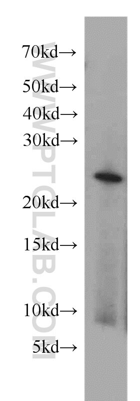 Western Blot (WB) analysis of HEK-293 cells using RAB2 Polyclonal antibody (15420-1-AP)