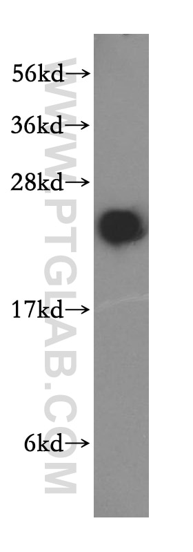 Western Blot (WB) analysis of mouse brain tissue using RAB2 Polyclonal antibody (15420-1-AP)