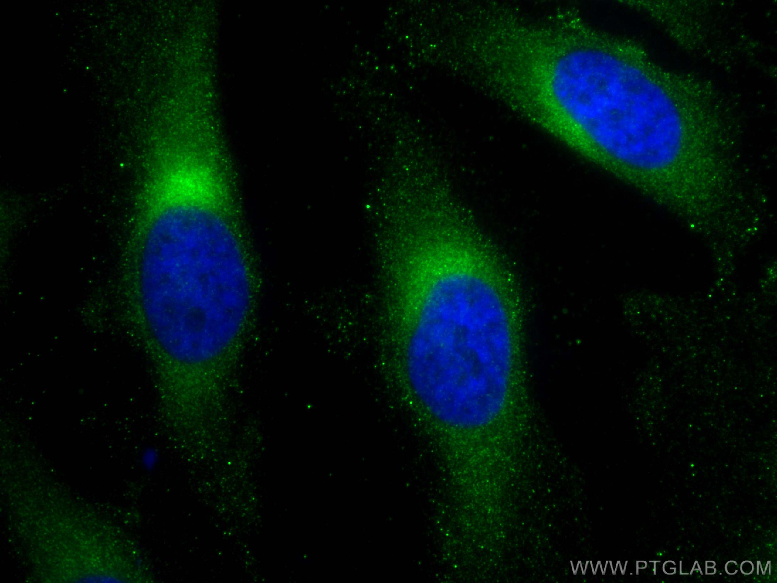 Immunofluorescence (IF) / fluorescent staining of HeLa cells using RAB2A Monoclonal antibody (67501-1-Ig)
