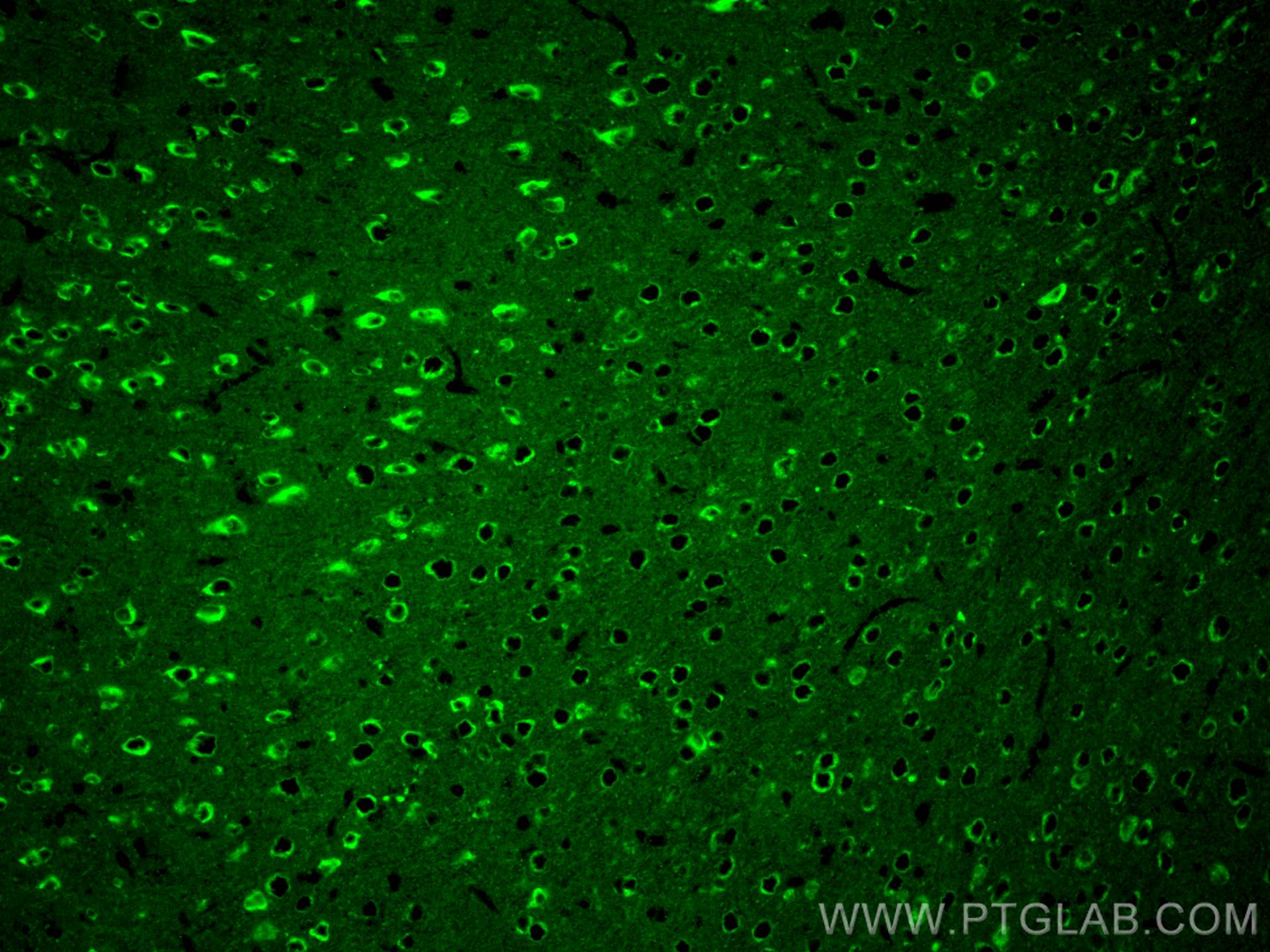 Immunofluorescence (IF) / fluorescent staining of mouse brain tissue using RAB2A Monoclonal antibody (67501-1-Ig)