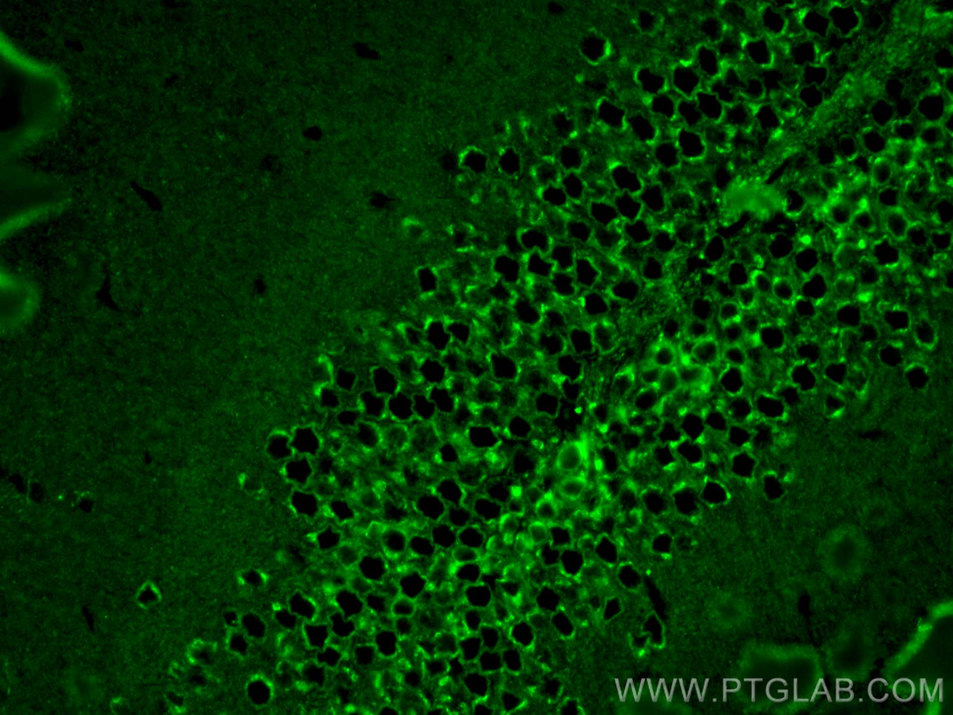 Immunofluorescence (IF) / fluorescent staining of mouse brain tissue using RAB2A Monoclonal antibody (67501-1-Ig)