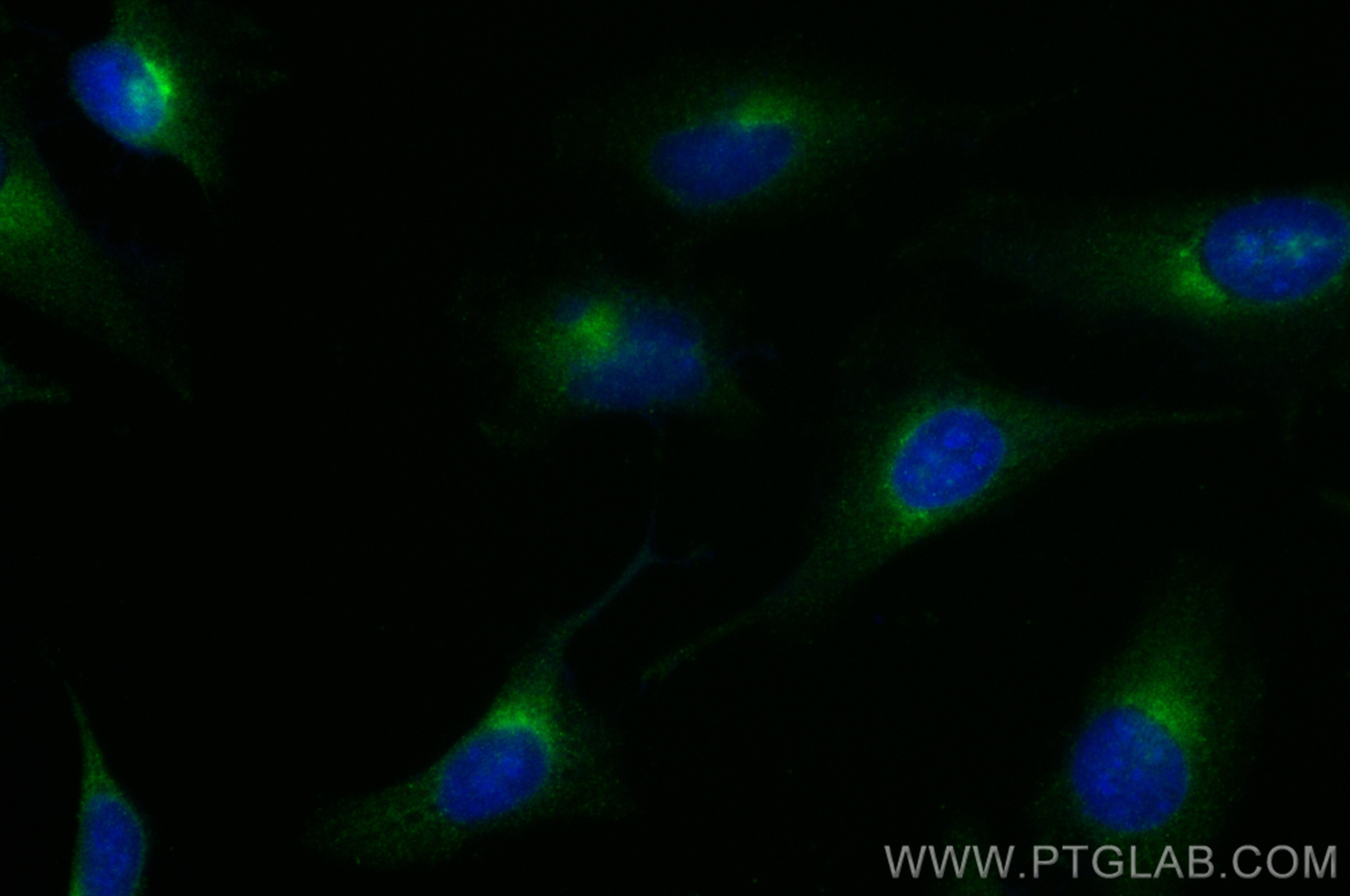 Immunofluorescence (IF) / fluorescent staining of HeLa cells using RAB2A Monoclonal antibody (67501-1-Ig)