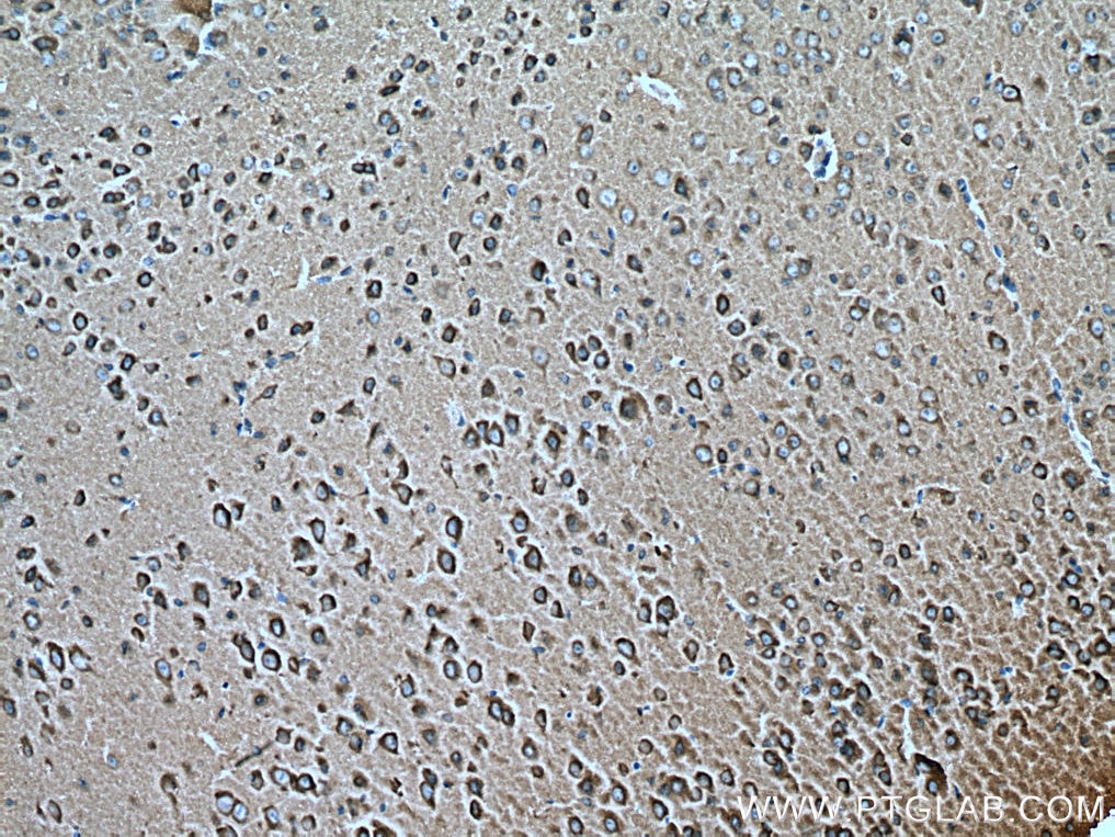 IHC staining of mouse brain using 67501-1-Ig