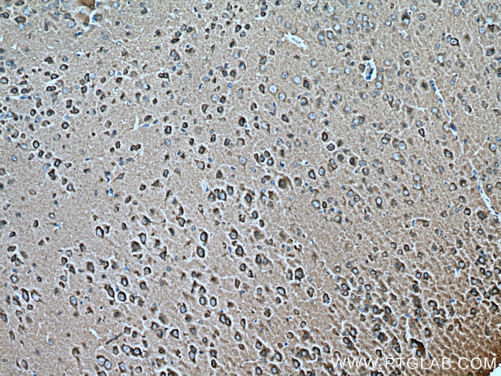 Immunohistochemistry (IHC) staining of mouse brain tissue using RAB2A Monoclonal antibody (67501-1-Ig)