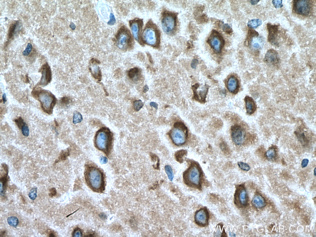 Immunohistochemistry (IHC) staining of mouse brain tissue using RAB2A Monoclonal antibody (67501-1-Ig)