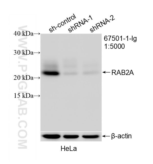 WB result of RAB2A antibody (67501-1-Ig; 1:5000; incubated at room temperature for 1.5 hours) with sh-Control and sh-RAB2A transfected HeLa cells. Western Blot (WB) analysis of HeLa cells using RAB2A Monoclonal antibody (67501-1-Ig)