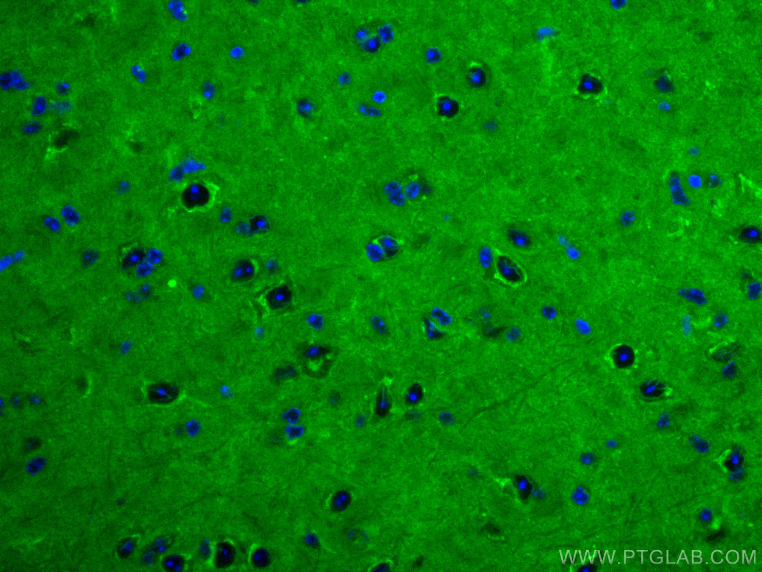 IF Staining of mouse brain using CL488-67501