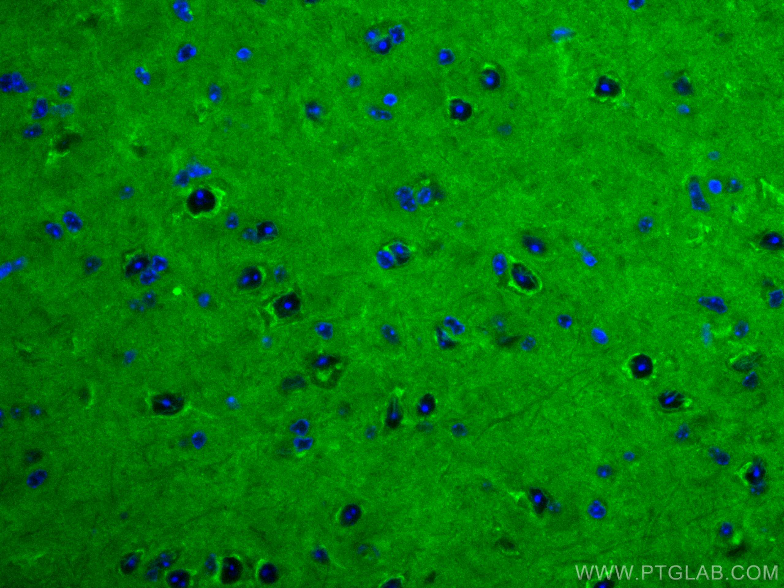 Immunofluorescence (IF) / fluorescent staining of mouse brain tissue using CoraLite® Plus 488-conjugated RAB2A Monoclonal ant (CL488-67501)