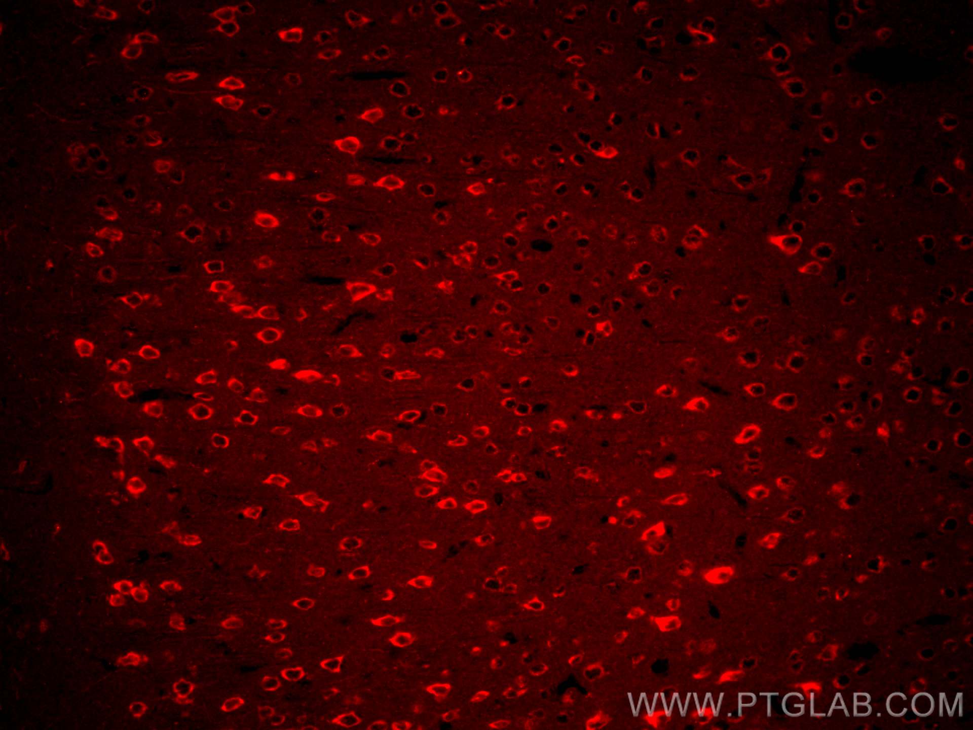 Immunofluorescence (IF) / fluorescent staining of mouse brain tissue using CoraLite®594-conjugated RAB2A Monoclonal antibody (CL594-67501)