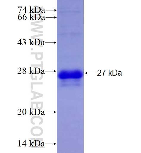 RAB2A fusion protein Ag7939 SDS-PAGE