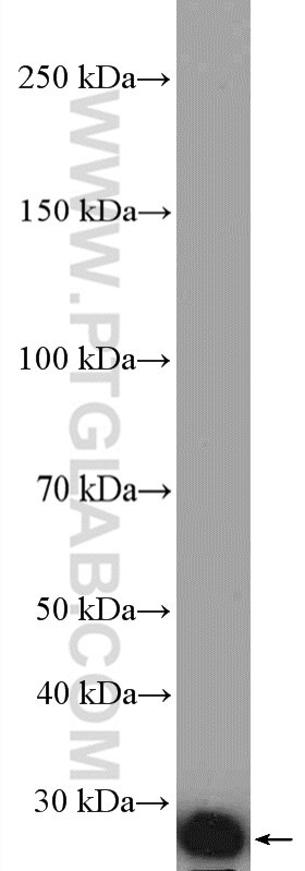 Western Blot (WB) analysis of HeLa cells using RAB2B Polyclonal antibody (11756-1-AP)