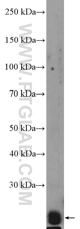 Western Blot (WB) analysis of mouse kidney tissue using RAB2B Polyclonal antibody (11756-1-AP)