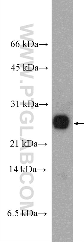 Western Blot (WB) analysis of mouse brain tissue using RAB2B Polyclonal antibody (11756-1-AP)