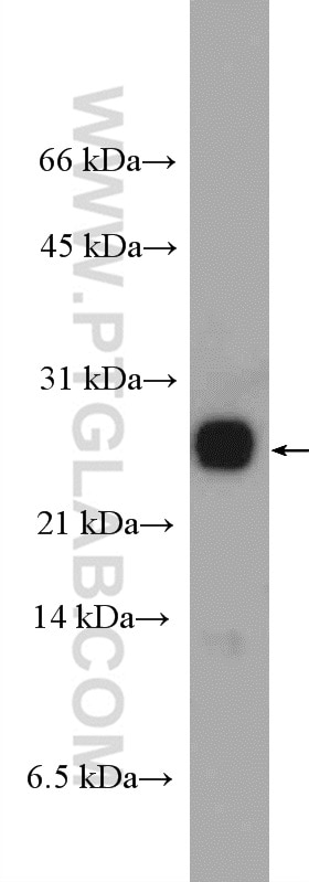 WB analysis of mouse brain using 11756-1-AP