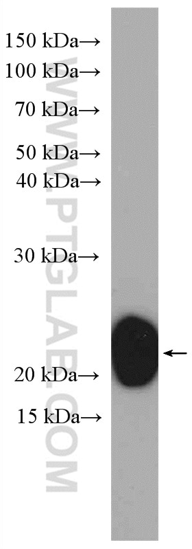 Western Blot (WB) analysis of rat brain tissue using RAB2B Polyclonal antibody (11756-1-AP)