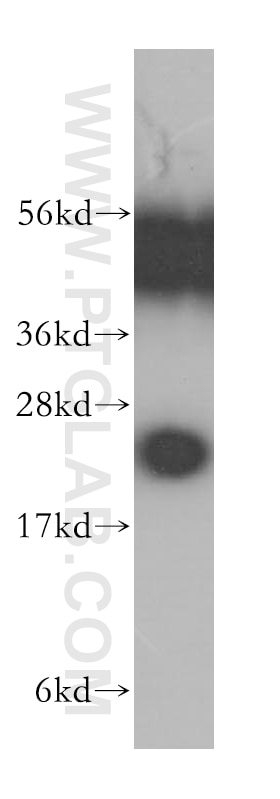 Western Blot (WB) analysis of HeLa cells using RAB2B Polyclonal antibody (11756-1-AP)