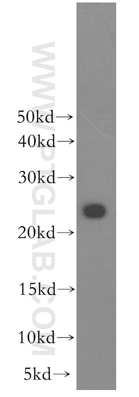 Western Blot (WB) analysis of human brain tissue using RAB2B Polyclonal antibody (11756-1-AP)